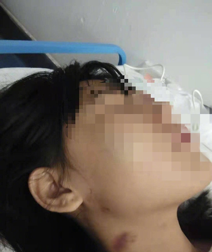 女子被打事件最新进展及其社会影响概述