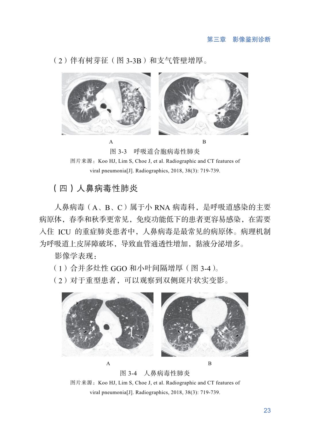 今日揭秘，新冠肺炎起源消息，揭开疫情起源神秘面纱